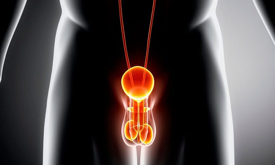 Sistema genitourinario infiammato per prostatite